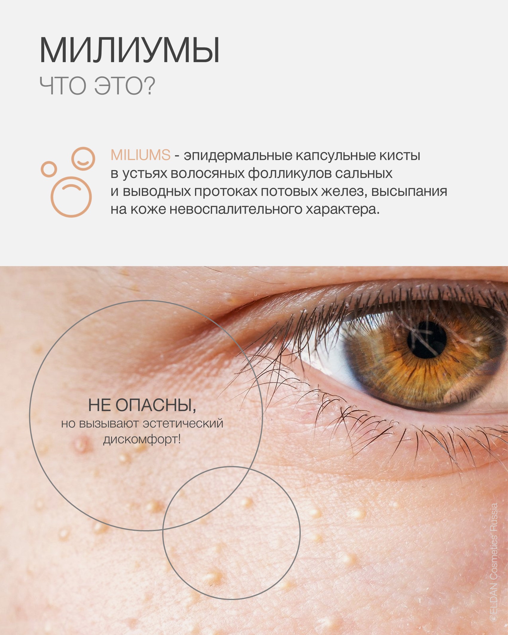 Пост милиумы 2.jpg  Пост милиумы 2.jpg